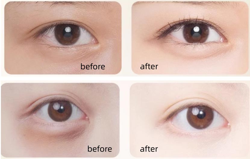 Gentle Eye Repair Essence